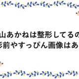 瀧山あかねは整形してるの？整形前やすっぴん画像はある？