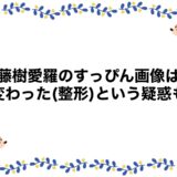 齋藤樹愛羅のすっぴん画像は？顔変わった(整形)という疑惑も！